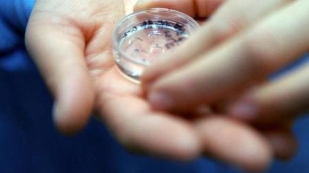 详细解读绥化市做长方案试管婴儿费用，长方案和短方案成功率有差别吗？