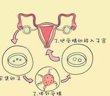 在揭阳市做试管婴儿长方案周期需要多久？超长方案促排流程是怎么样的？