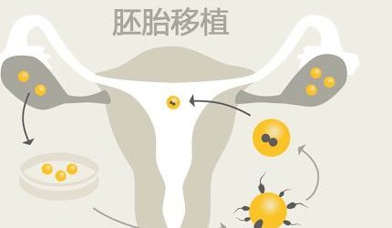 在靖江市做试管婴儿长方案周期需要多久？超长方案促排流程是怎么样的？